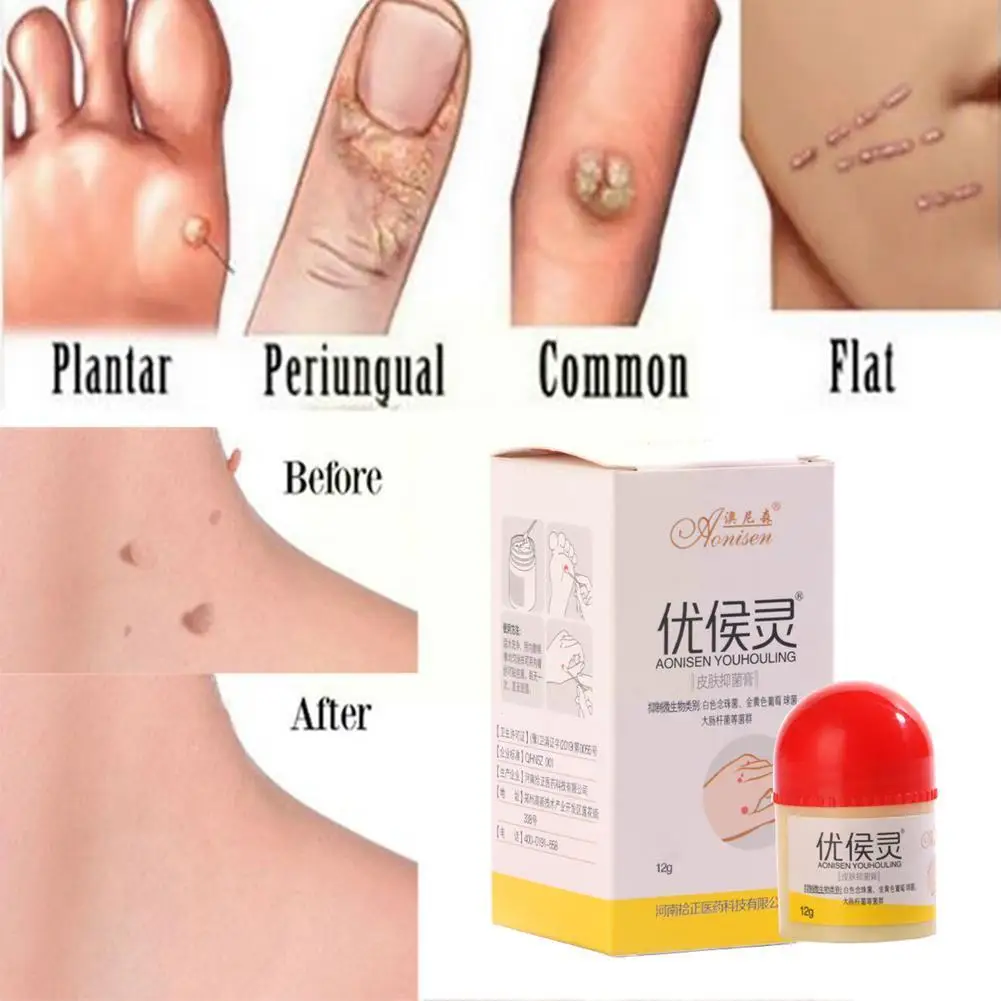 Пластырь искусственная кожа рельефный крем экстракт бородавок