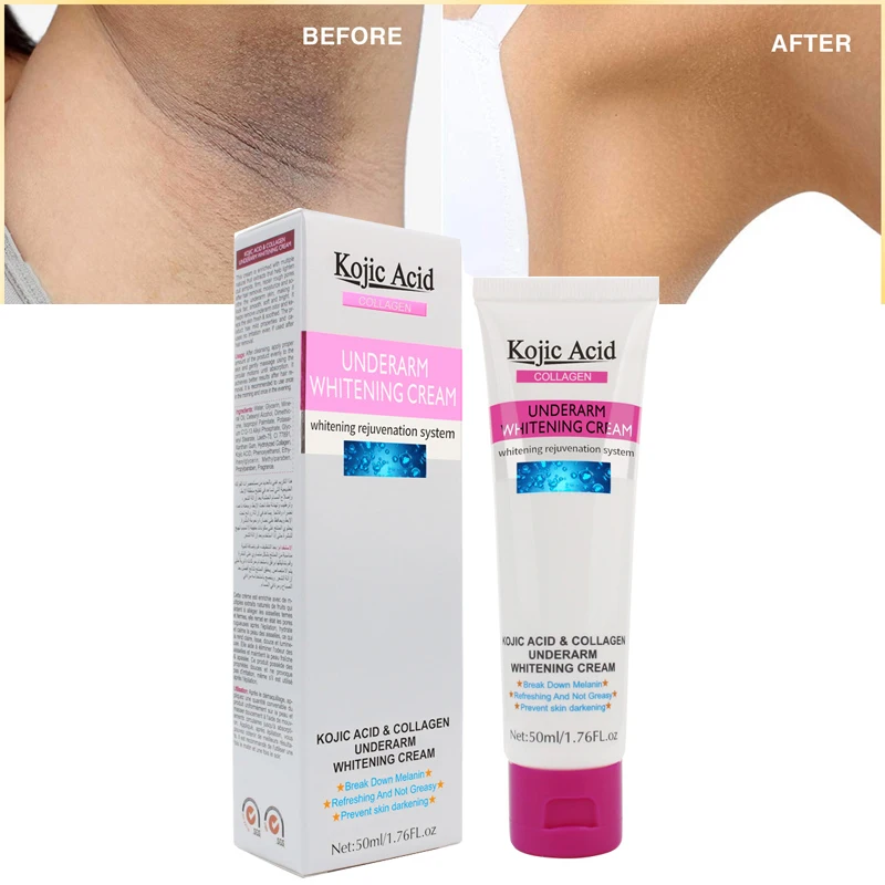 

50 мл Kojic кислота для женщин Отбеливание подмышки крем подмышек частная часть уход за кожей сосков крем для восстановления тела подмышек