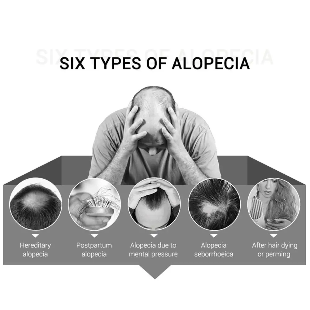 Мощное средство для лечения женской кожи питательный экстракт имбиря уход за