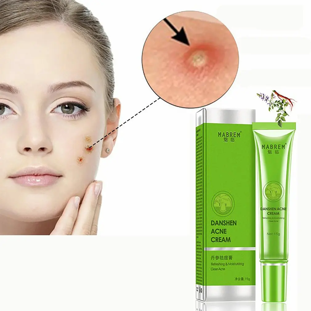 Портативный парк Спрингс аккор анти-лечение акне гель увлажняющий удаляет рубцы