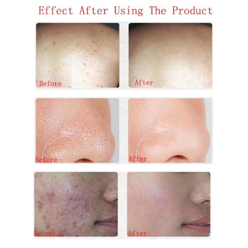 

1 Pc 130g Tibetan Herbal Handmade Soap Refreshing Oil Control Cleansing Essential Oil Handmade Soap