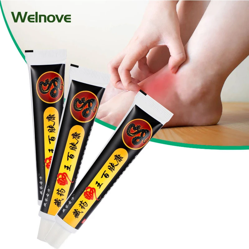 

25 г/шт. травяная мазь от псориаза, экземы, дерматита, крем, травы, антибактериальный противозудный Urticaria, защита рук и ног от зуда