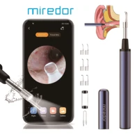 miredor smart visual ear cleaner otoscope with app enable camera 3 5mm1080pwifi endoscope earwax removal kits adultschildren