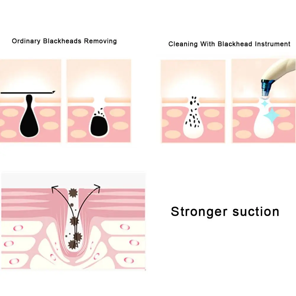 

Electric Blackhead Instrument To Blackhead Artifact Home Electronic Cleansing Instrument Beauty Instrument Pore Cleaner