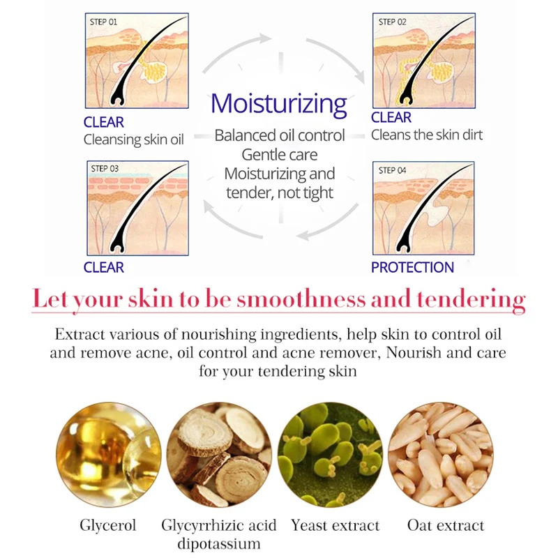 30 г лечение акне очищающий крем для лица против сокращение пор удаление жирной