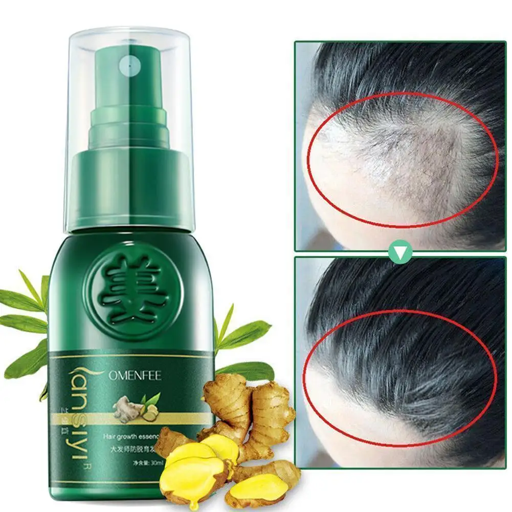 

50ml Damaged Thinning Repair Hair Growth Spray Serum Hair Nutrient Solution Anti-loss Fast Grow Nourishing Solution