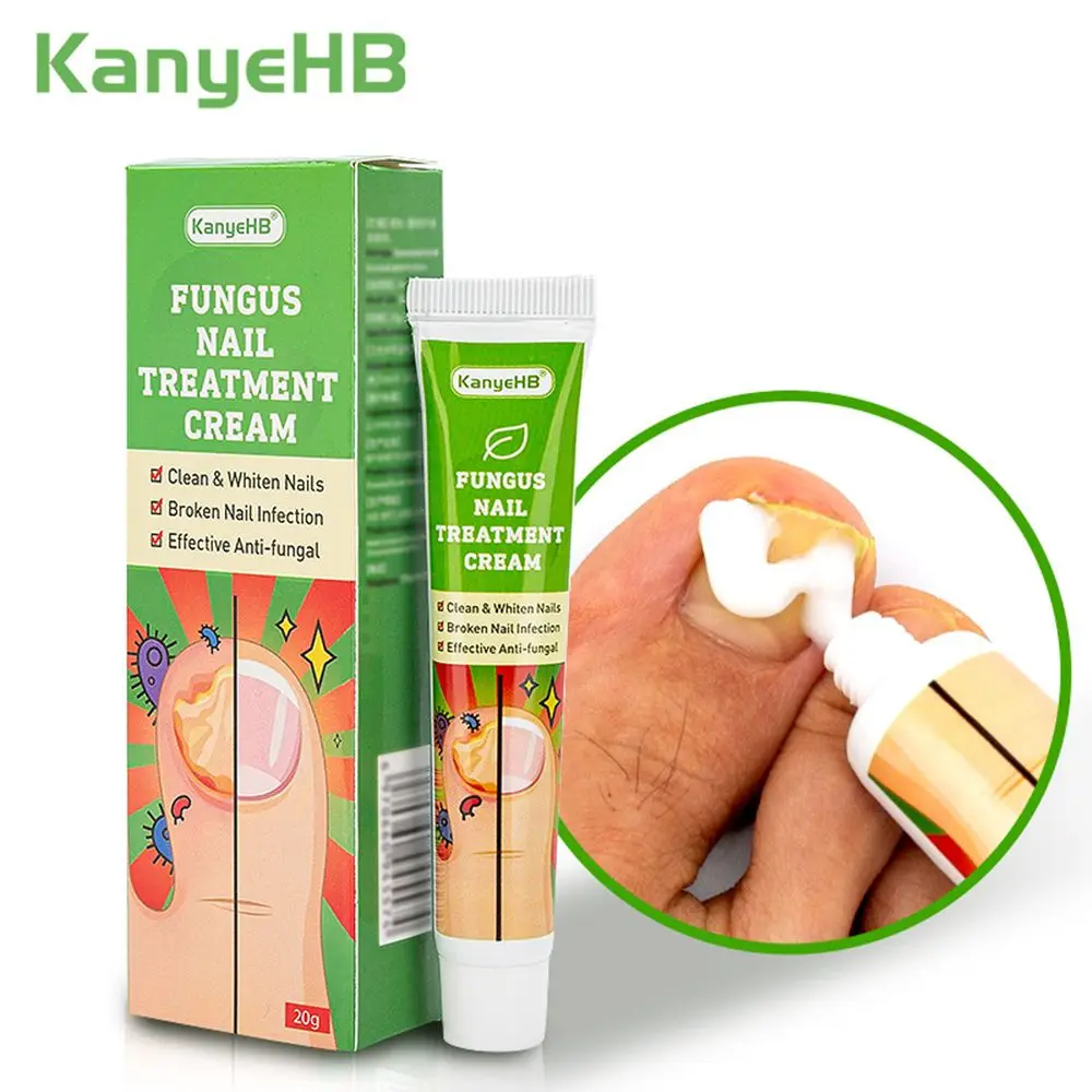 

Plaster Feet Whitening Remove bad nails Toe Care Ointment Paronychia Nail Fungus Treatment Cream Onychomycosis