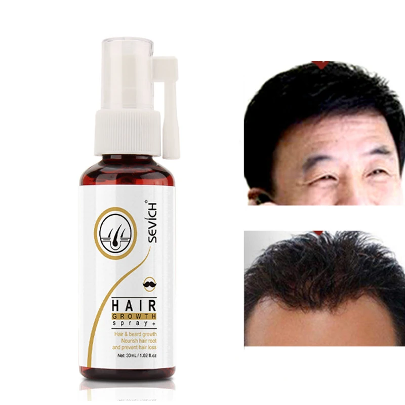 

Sevich 50ml Hair Growth Spray Active Scalp Hair Regrowth Essencial Intensive Spray Hair Loss Treatment Hair Care