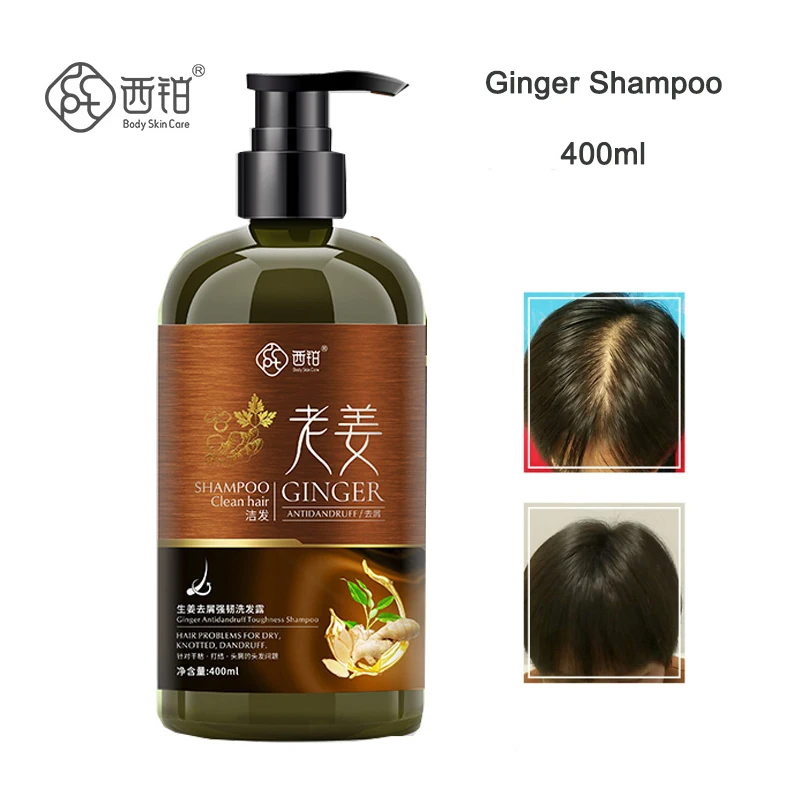 Шампунь для роста волос имбиря против перхоти контроль жирности питание