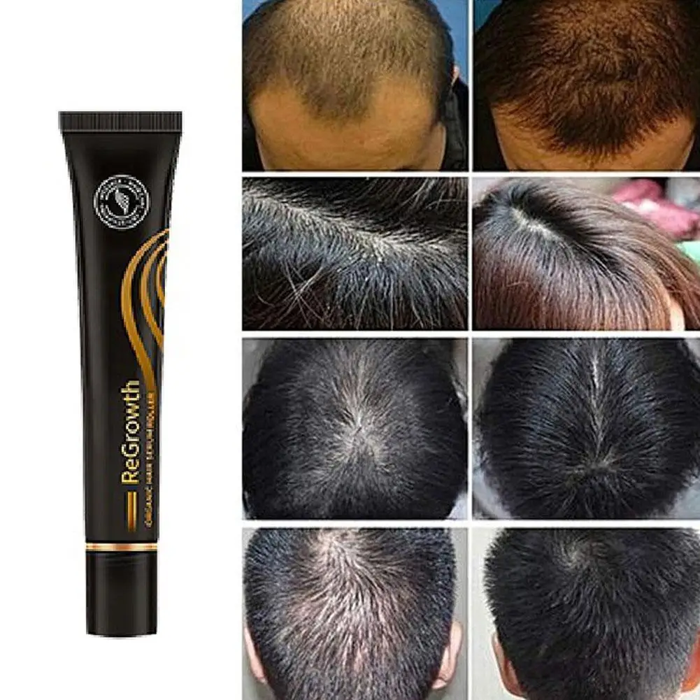

20ml Regrowth Organic Hair Serum Roller Set Hair Care Anti Stripping Liquid Roll-On Massager Hair Growth Essence Hair Care Serum