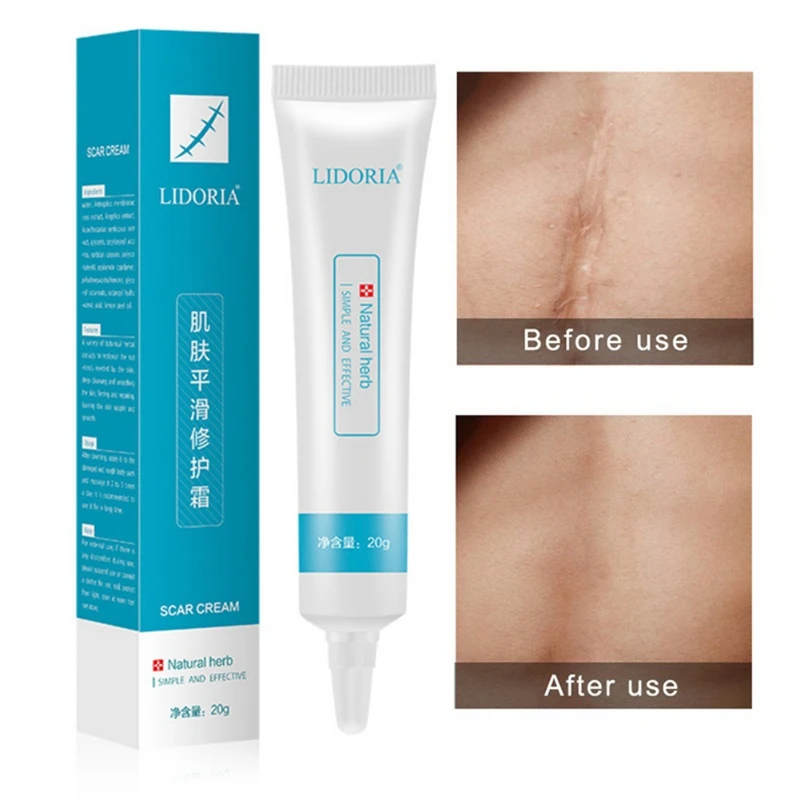 Remove Pimple 20g Skin Smoothing Cream Repair Essential Liquid Hydrating Marks Skin Care Serum