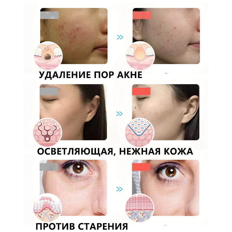 Светодиодная фотонная маска для лица косметическая терапия омоложение
