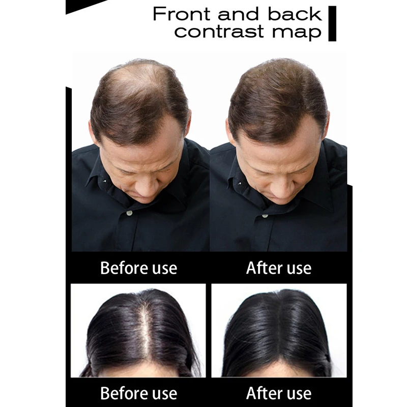 Волокна для волос SEVICH 100 г сменный пакет продукты выпадения пудра роста