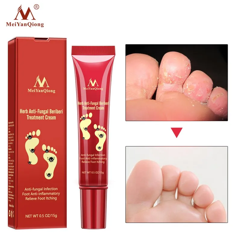 

15g Nail Care Herbal Nail Repair Cream Anti Fungal Toe Nail Fungus Treatment
