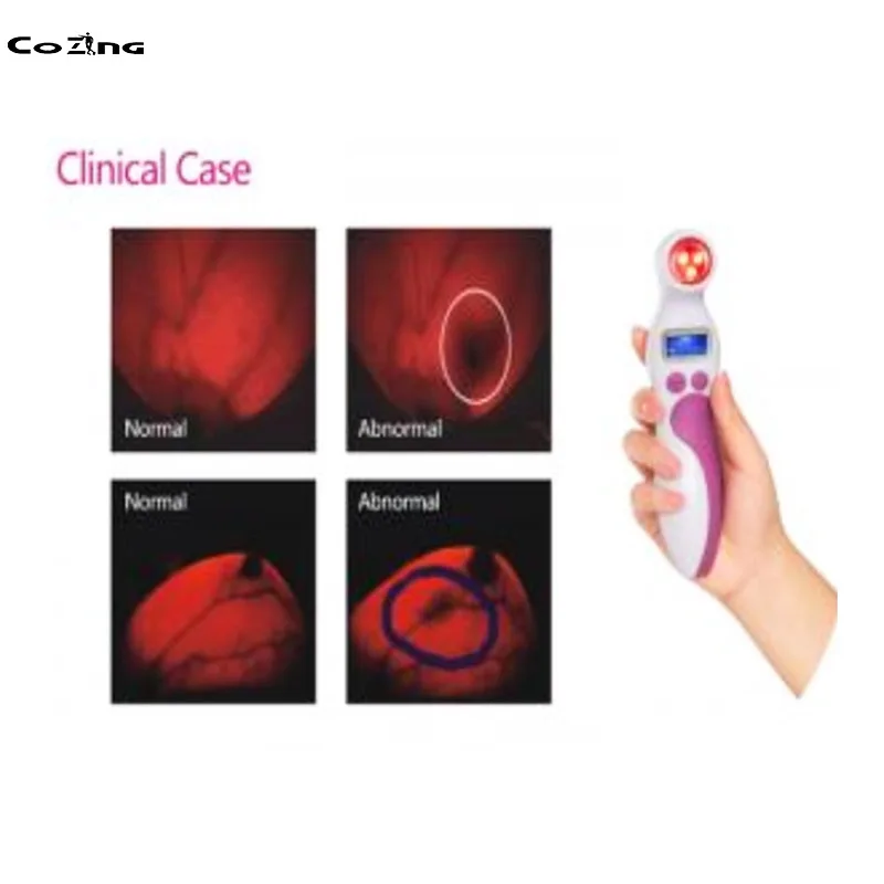 Female Healthcare Breastlight Infrared Light Breast Scanner Testing Analyzer Self Examination | Красота и здоровье