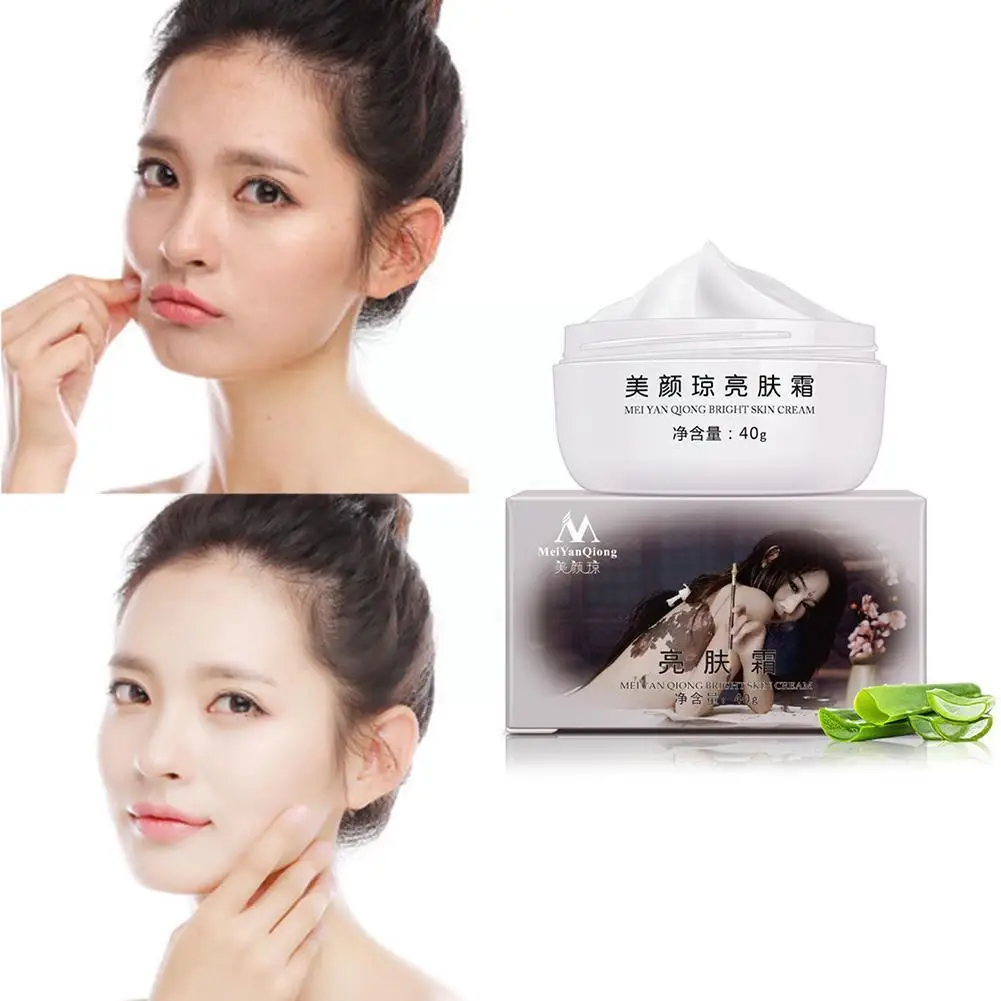 

40g Powerful Whitening Freckle Cream Remove Melasma Cream Strong Whitening Effects Pigment Melanin Moisturizing Acne Skin S F4D6