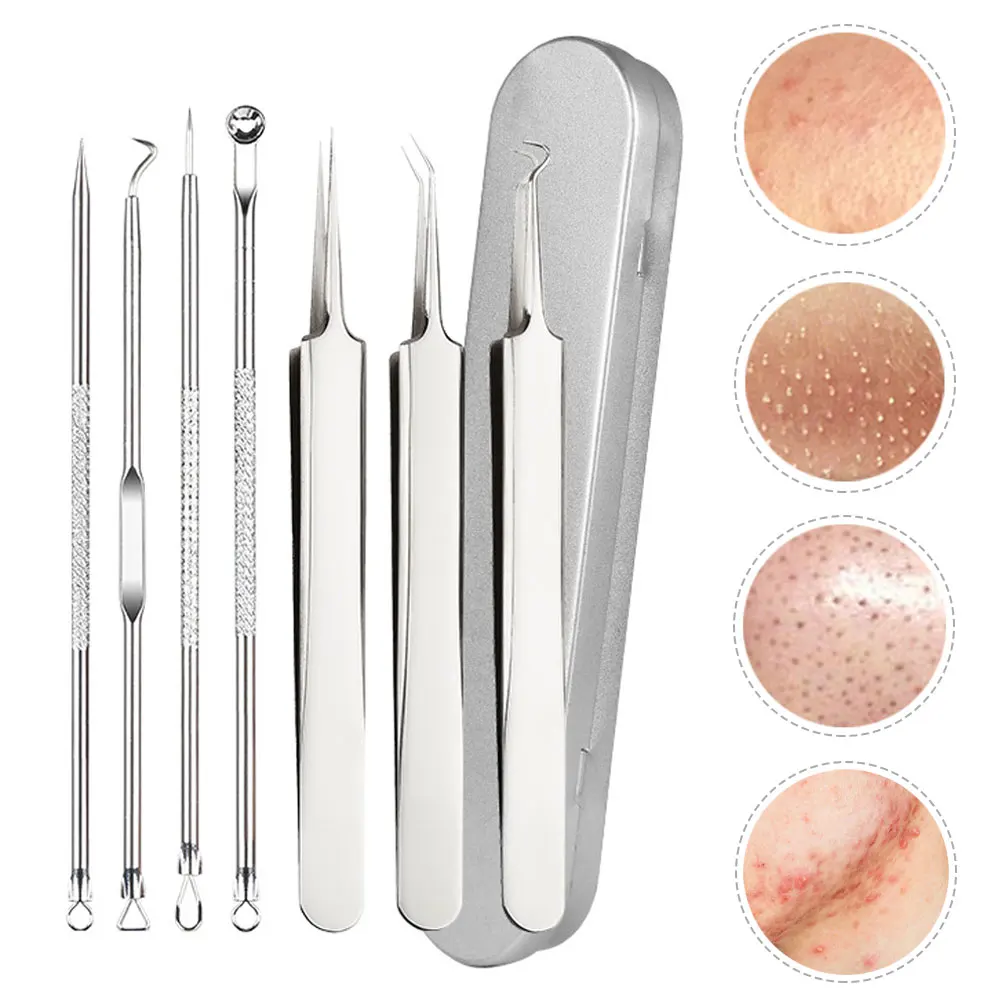 Инструмент для удаления чёрных точек на лице из нержавеющей стали |