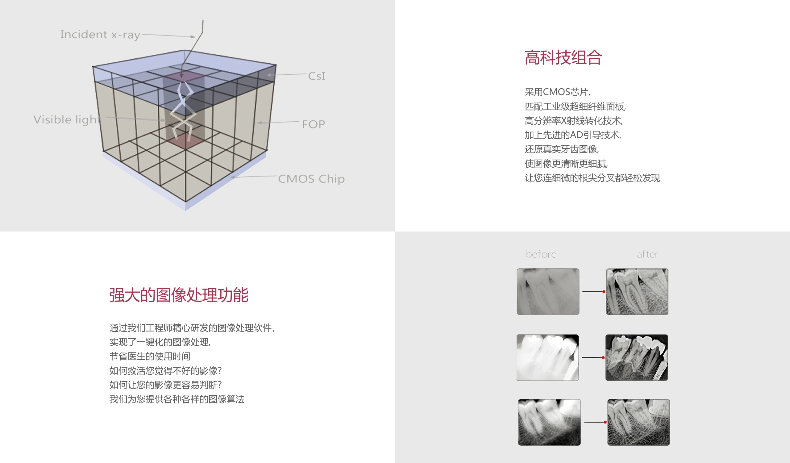 Стоматологический рентгеновский Датчик Runyes U980 стоматологический US980 | Красота и