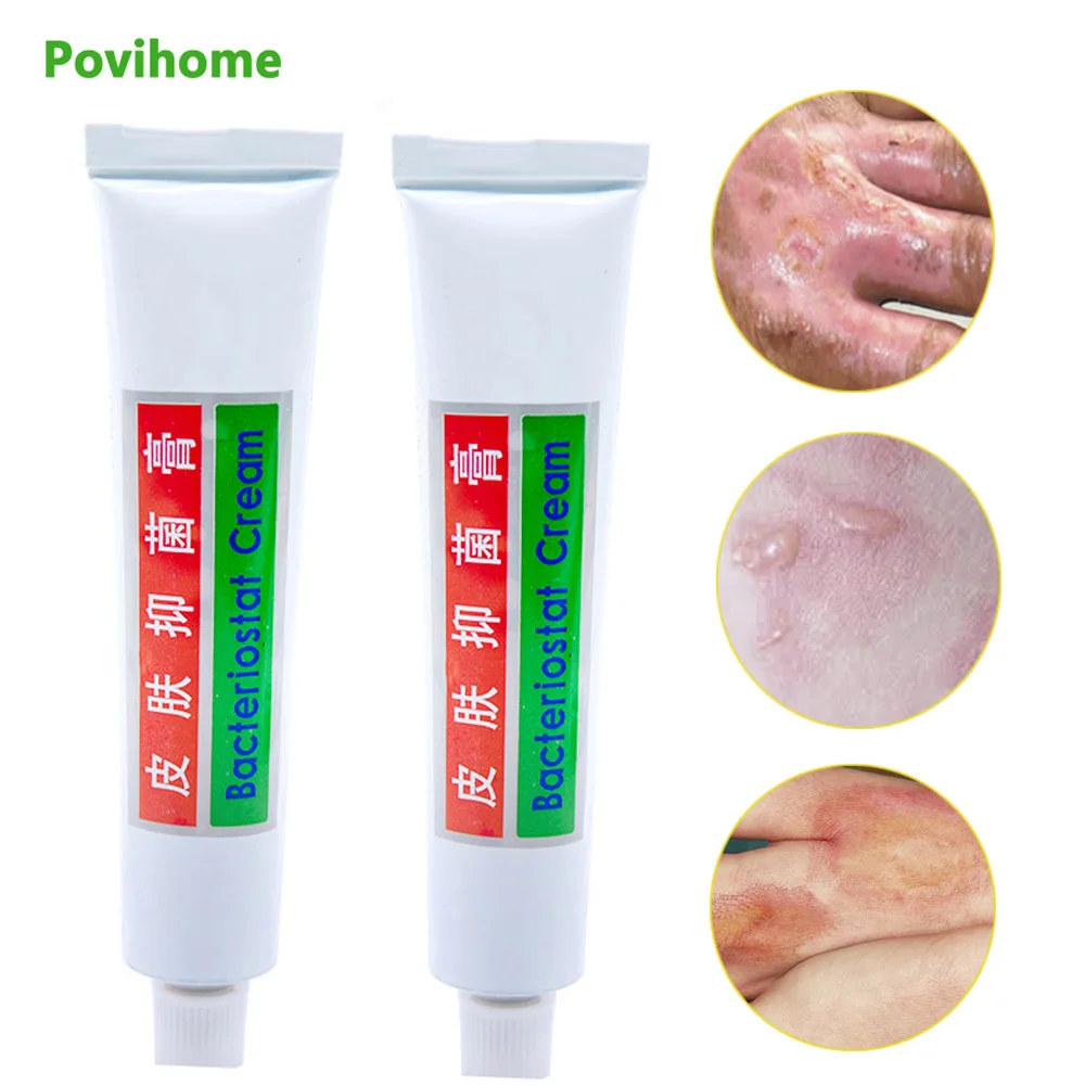 2 шт. обезболивающие мази для ухода за кожей 20 г | Красота и здоровье