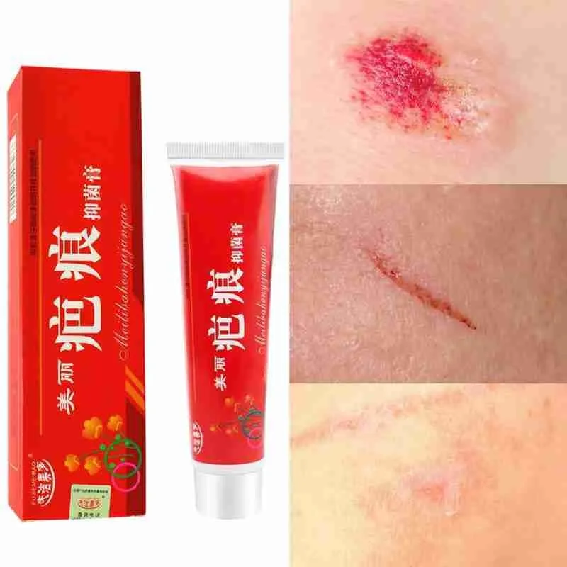 

Scar Acne Removal Cream Face Gel Remove Pimples Stretch Marks Acne Smoothing Whitening Moisturizing Body Skin Care