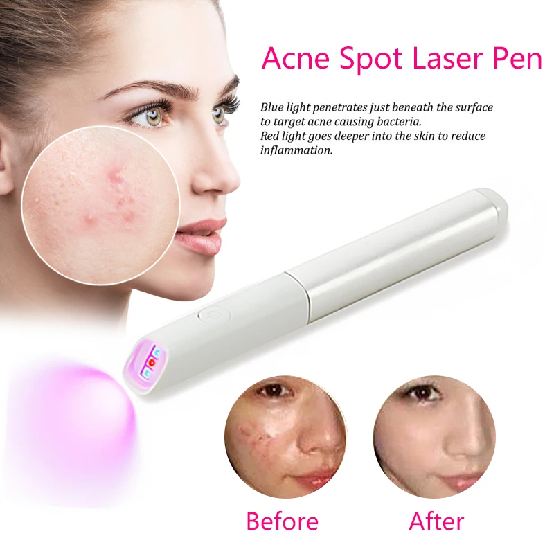 

Blu-ray Acne Pen Blue Light Red Therapy Acne Spot Treatment Laser Pen Blackhead Blemish Remover Scar Wrinkle Removal Device