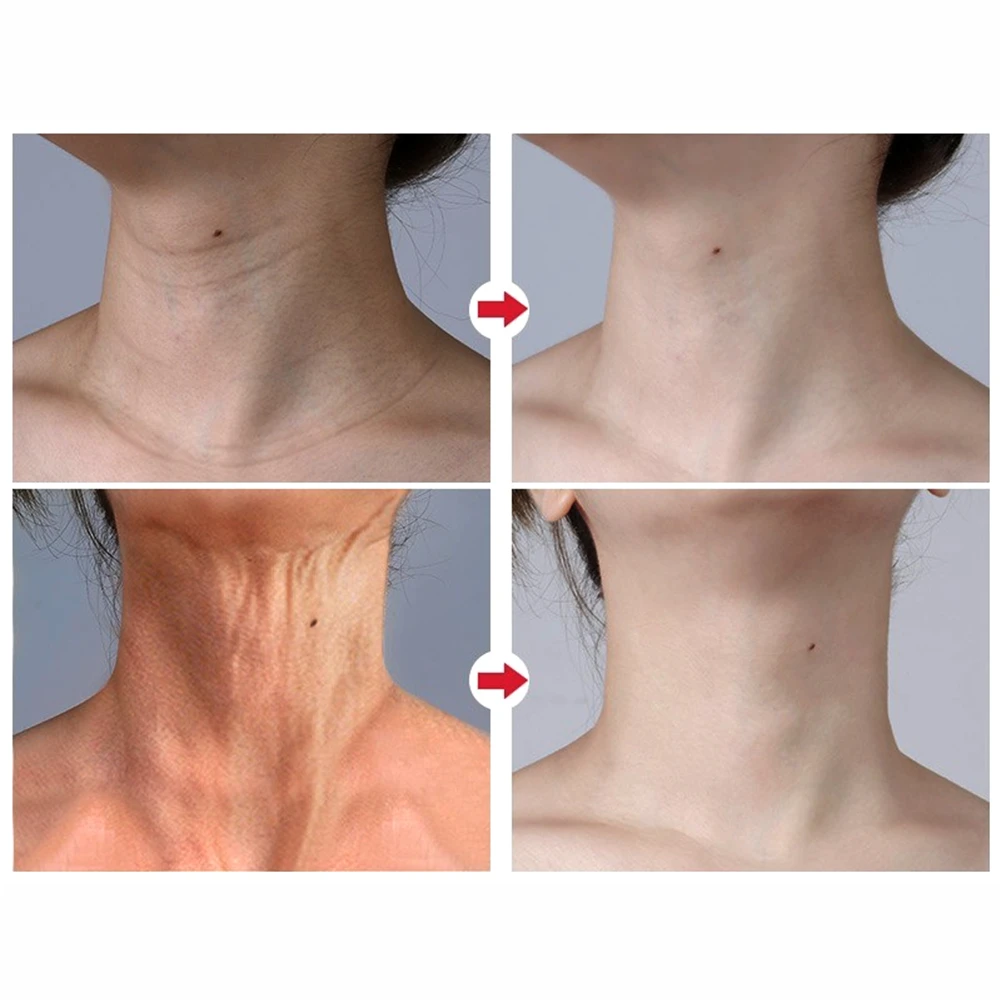 OMYLADY шейные маски крем укрепляющий кожу против морщин анти-возрасное отбеливание