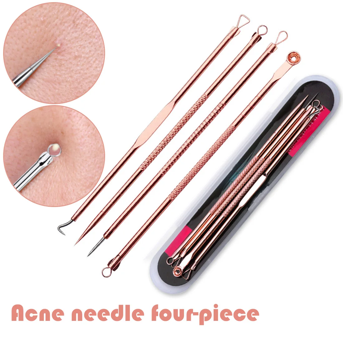 

4pcs Blackhead Remover Needle Comedone Acne Blackhead Pimple Extractor Tool Facial Pore Cleaner Spoon for Face Skin Care Tool