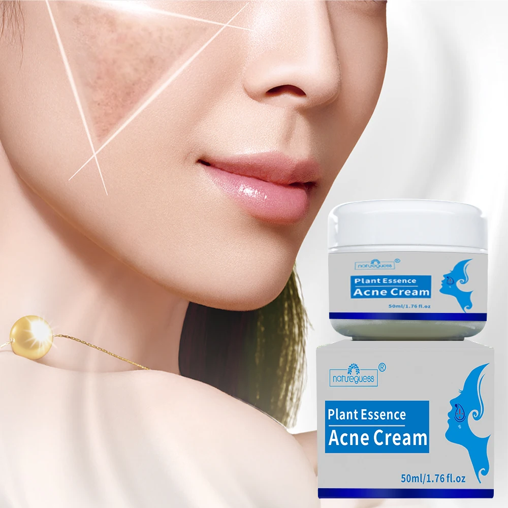 Крем для удаления акне 50 г контроль жирности сужение пор удаление шрамов угрей