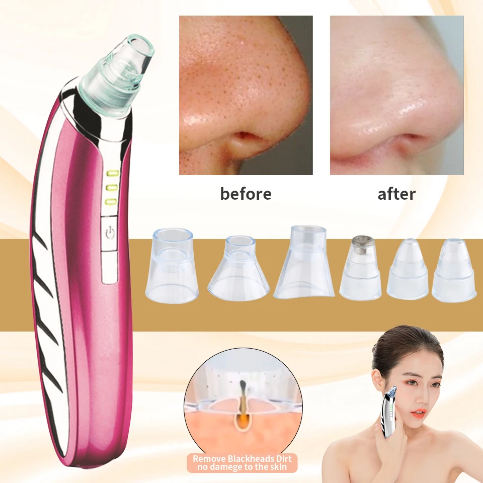 Прибор для удаления черных точек электрический прибор ухода за кожей лица