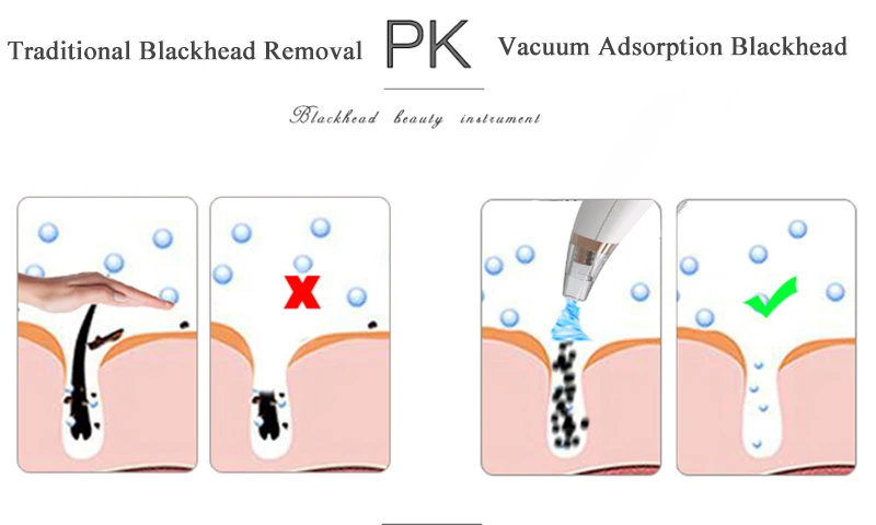 Blackhead Remover Acne Pore Cleaner Vacuum Electric Nose Face Deep Cleaner Pimple Remover Suction Facial Diamond Skin Care Tool