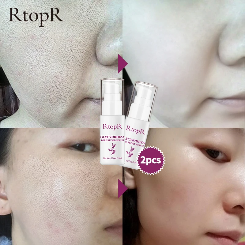 2 шт. отбеливающий крем для лица от морщин | Красота и здоровье