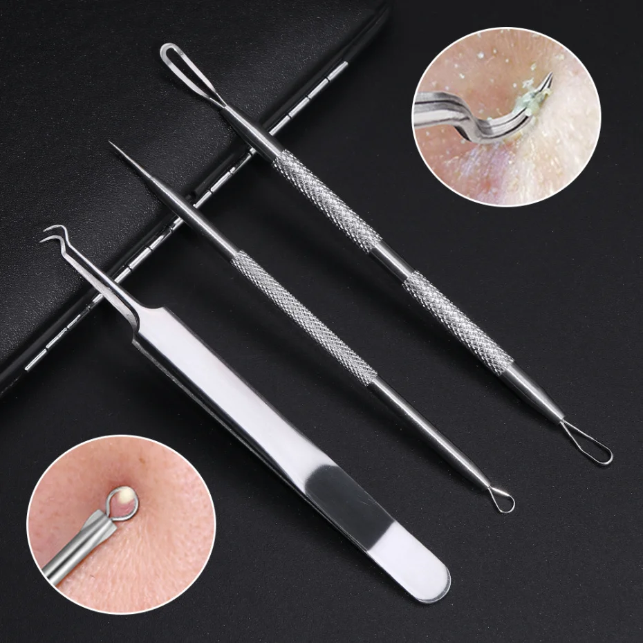 3 шт. иглы для удаления угрей и прыщей из нержавеющей стали лечение чёрных точек