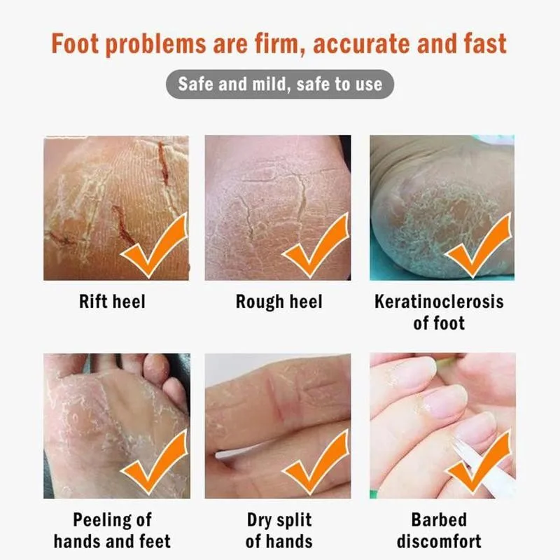 

20ml Moisturizing Cream Oil Foot Cream Dead Skin Remover Repair Moisturizing Whitening Exfoliating Anti-dry Foot Crack