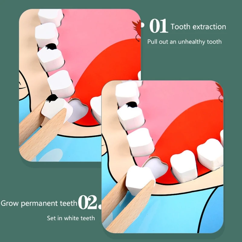 

1 Set Children Dentist Toys Pretend Role Play Early Educational Birthday Gifts 54DF