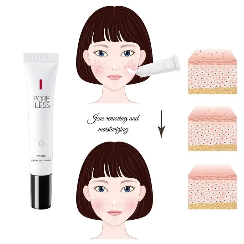 20g Acne Cream Delicate Repair Acne Scar Marks Shrink Face Control Acne Oil Moisturizing Beauty Remove Cream Pores J1A7