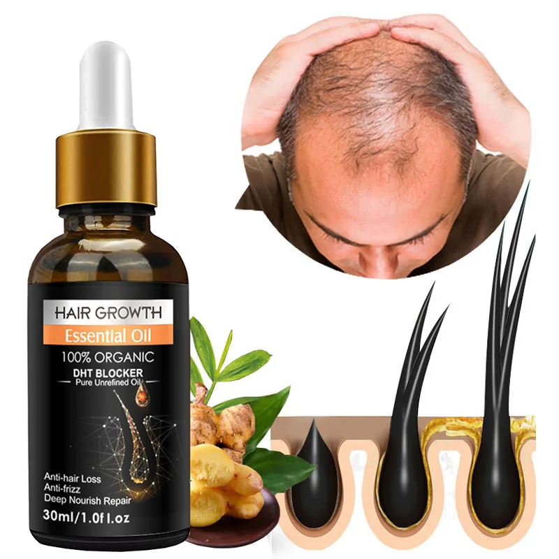 

Ginger Hair Growth Essential Oils Anti Hair Loss Essence Hair Growth Products Fast Germinal Liquid Repair Nourishing Hair Care