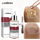 Восстанавливающая Сыворотка для ногтей LANBENA, противогрибковое Лечение ногтей, удаление онихомикоза, питание, осветление рук, ног, уход за ногтями