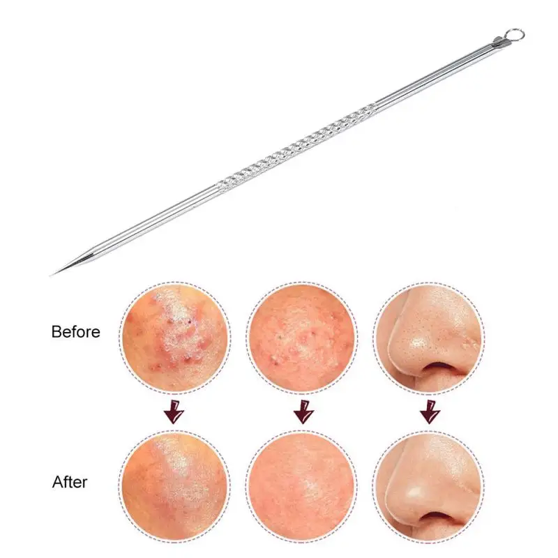 

1pc Stainless Steel Blackhead Remover Needles Extractor Dots Cleaner Acne Blemish Needles Black Spots Pore Beauty Tools TXTB1