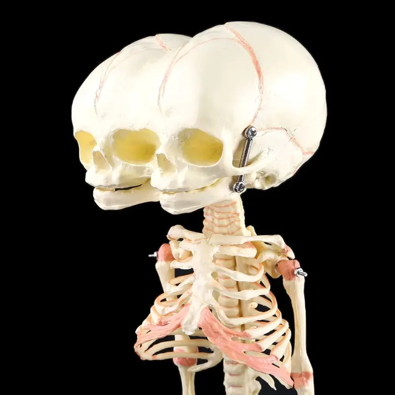 

Human Baby Deformed Head Skull Research Model Skeleton Anatomical Brain Anatomy Teaching Study Display