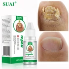 Средство для лечения грибков ногтей, эссенция для ухода за ногами, отбеливание ногтей на ногах, удаление грибка на ногтях, антиинфекционный гель для лечения паронихии и онихомикоза