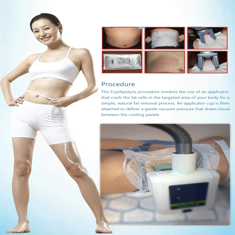 5pcs High Quality Antifreeze Membrane Anti Freezing Freeze Film for Fat Treatment Cryo Pad | Красота и здоровье