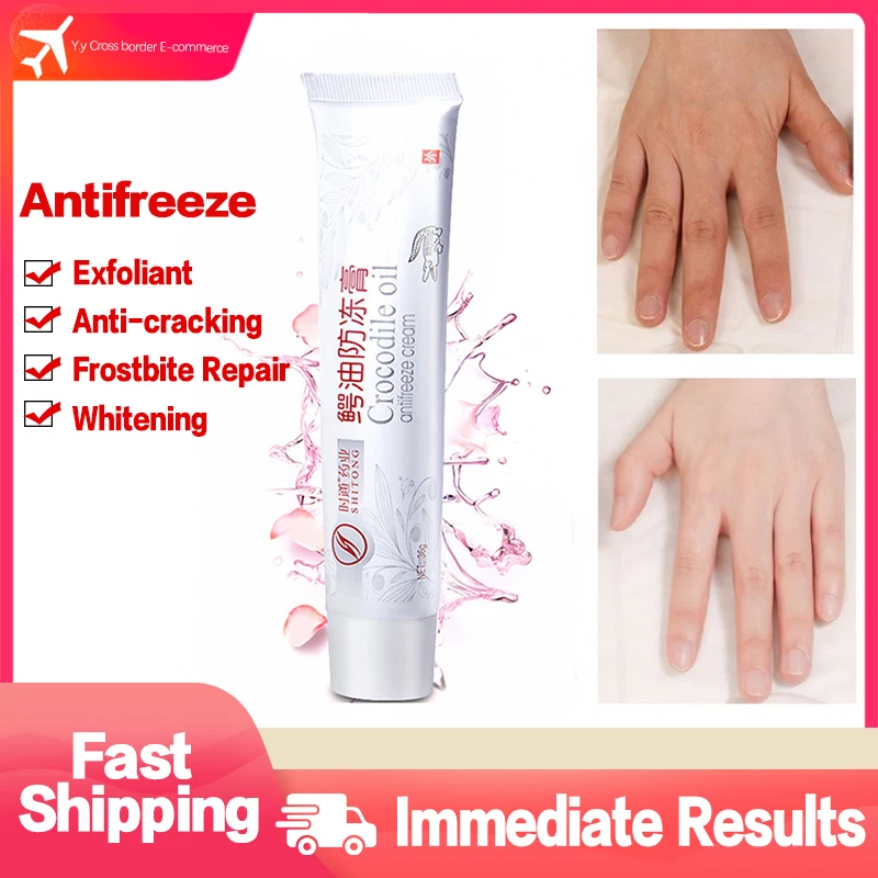 

Крем для рук и ног с эффектом трещин, восстанавливающий крем для пятки, от морщин и трещин, антифриза, удаление омертвевшей кожи, уход за лапа...