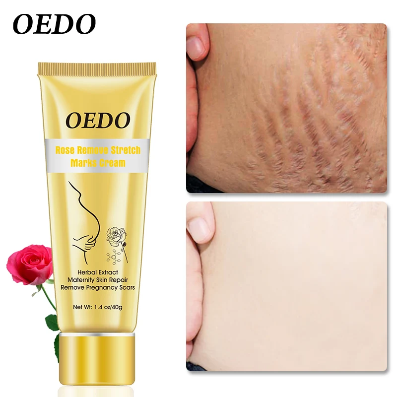 Крем для устранения растяжек и ожирения после родов антивозрастной укрепляющий