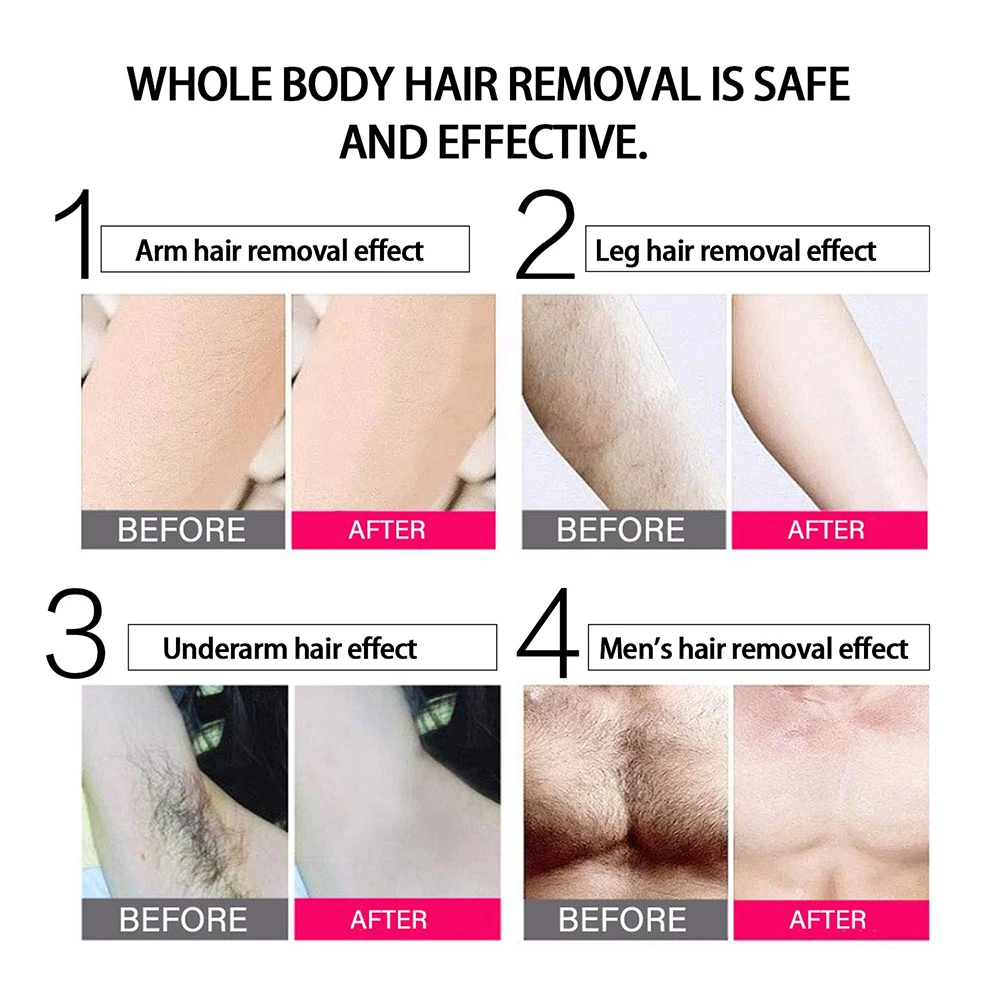 

Epilator for Women IPL Laser Hair Removal Machine Permanent Depilador 500000 Flash Trimmer Female Depilator Facial Hair Remover