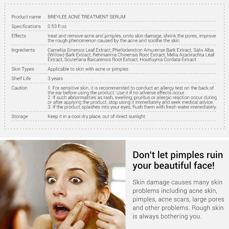 BREYLEE Acne Treatment Serum Facial Essence Anti Scar Removal Cream Face Skin Care Whitening Repair Pimple Remover For | Красота и