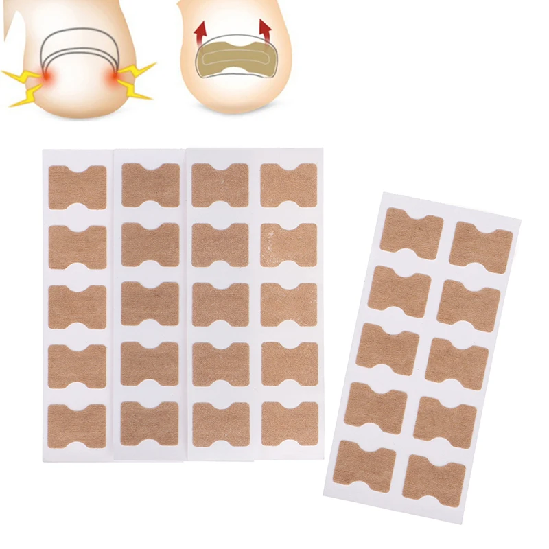 

20 Вт, 30 Вт шт коррекция ногтей наклейки вросшие ногти для ног "францзуский маникюр" корректор патчи паронихии обработки восстановить коррек...