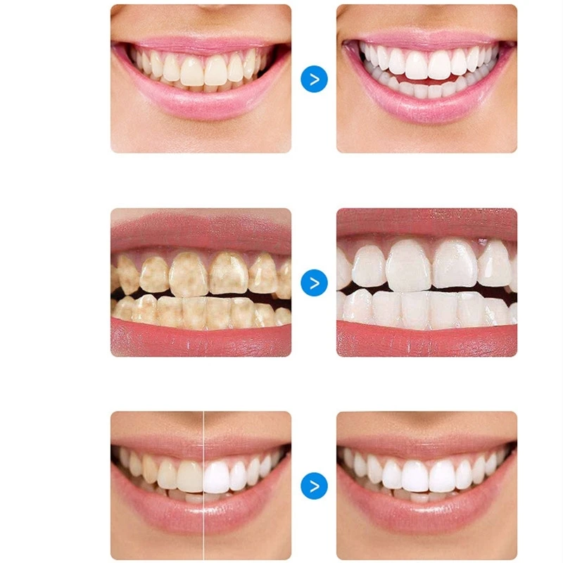 

Bright White Pearl Teeth Powder Toothpaste Remove Yellow Teeth Stains Smoke Stains Tartar