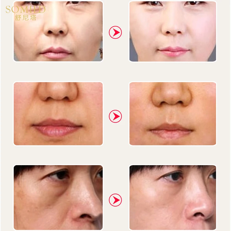 Сыворотка для лица HEMEIEL растительная эссенция антивозрастной витамин Е удаление