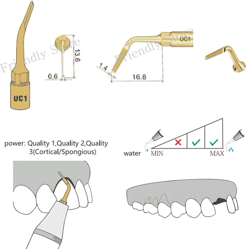 

UC1 Oral Hygiene Dental Bone Surgery Tip Compatible With MECTRON WOODPECKER PiezoSurgery Exelcymosis tip For Cutting Ligaments