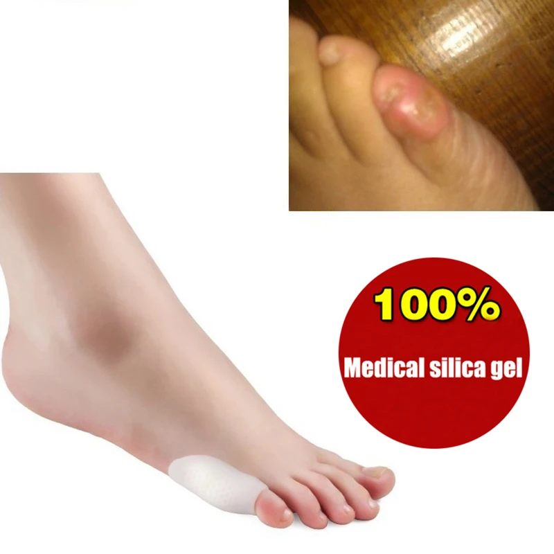 Уход за ногами антимозольный гель Маленькая подушка оболочка разделители